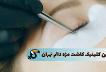 بهترین کلینیک کاشت مژه دائم تهران